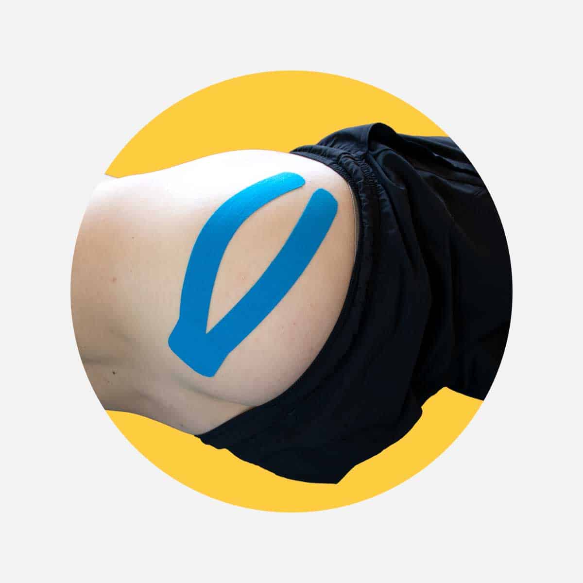 Tape baldemusklen mod iskiassmeter med kinesiologi tape