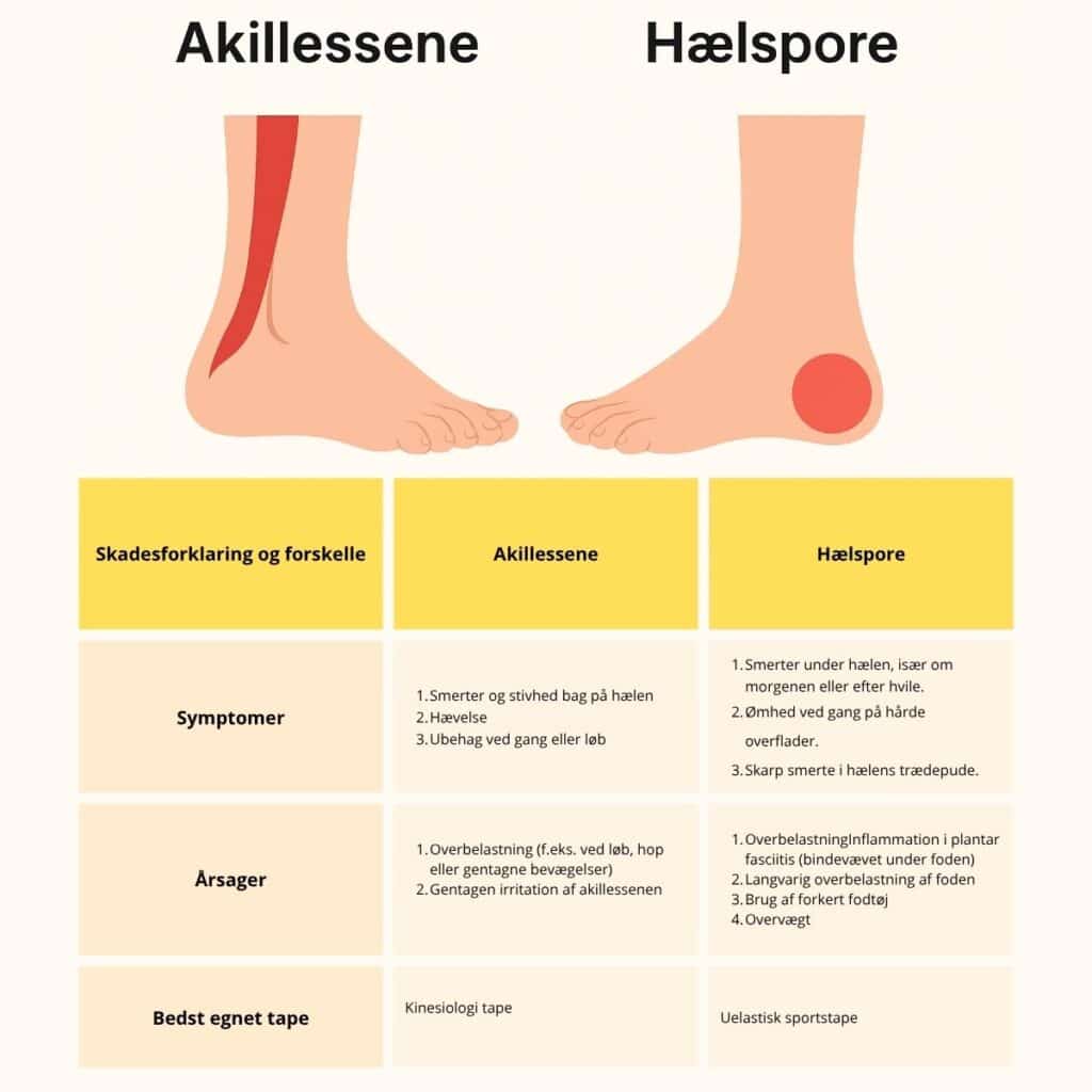 Infografik om skadeforskelle på hælspore og akillessene