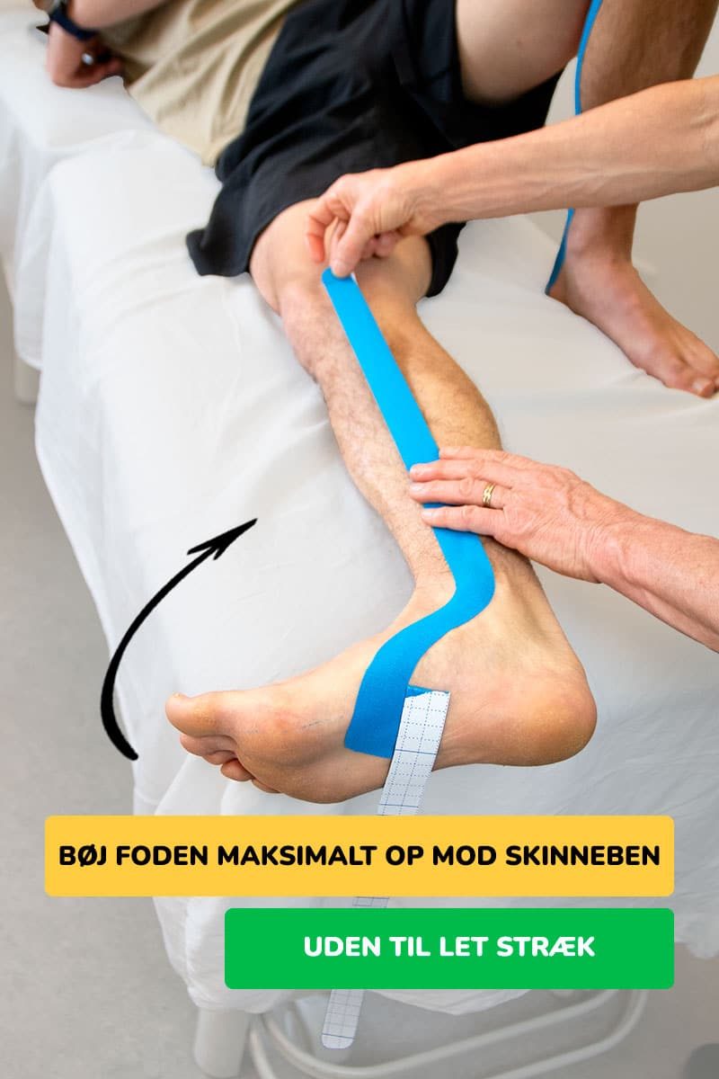 Kinesiologi tape inderside skinnebensbetændelse instruktioner trin 2