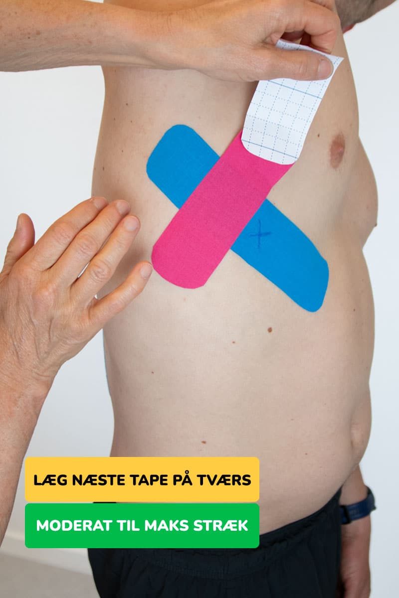 Instruktion til at tape trykket ribben med kinesiologi tape trin 2