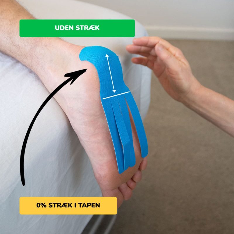 Tape svangsenebetændelse med kinesiologi tape 2